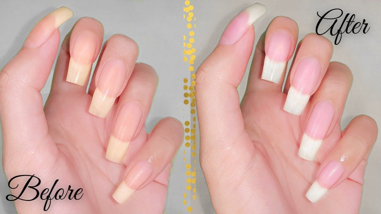 How to Whiten Nails in 5 Minutes  Whiten Nails at Home  Whiten Yellow 