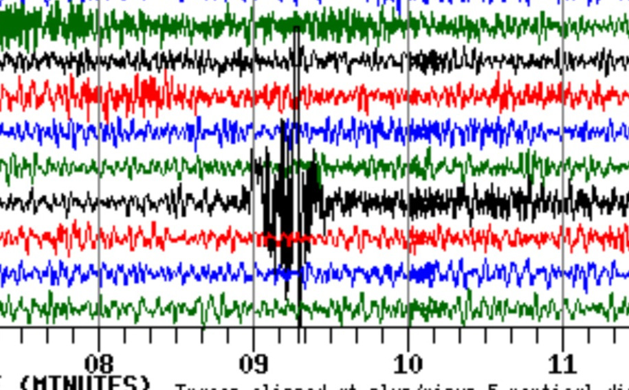 When I Move, It’s an Earthquake Rumble: Exploring Unusual Sensations