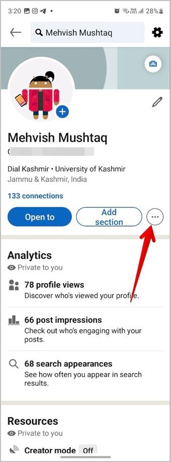 What Is My URL for LinkedIn? Finding and Sharing Your LinkedIn Profile URL