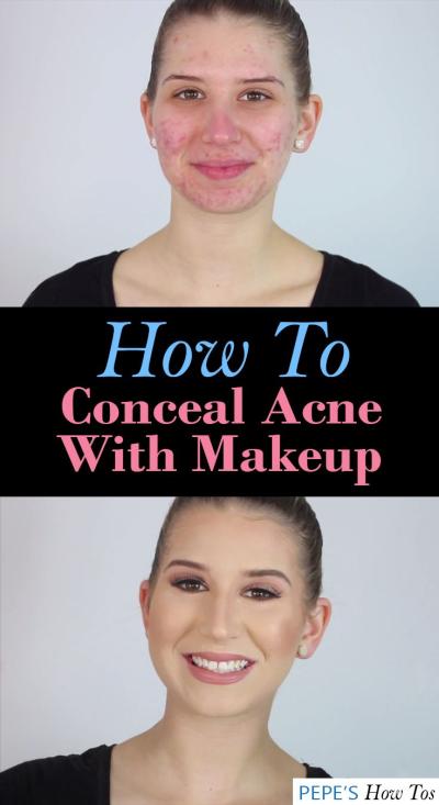 How to Cover Up Acne with Makeup: Easy Tips for a Smooth Finish on Dailymotion
