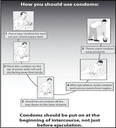 How to Use a Condom: A Step-by-Step Guide on Dailymotion