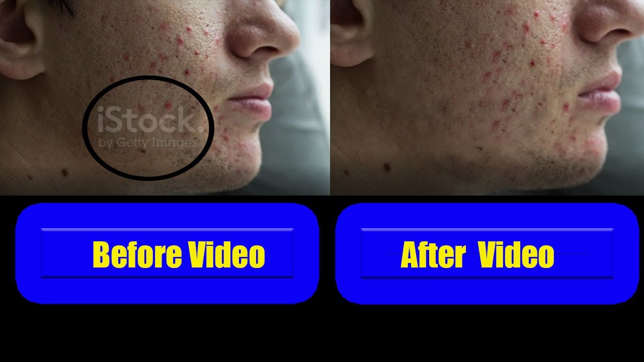 How to Remove Logos or Watermarks in Adobe After Effects