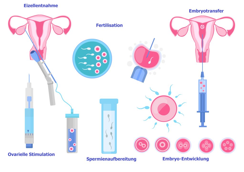 IVF Injections How Many Days in Urdu