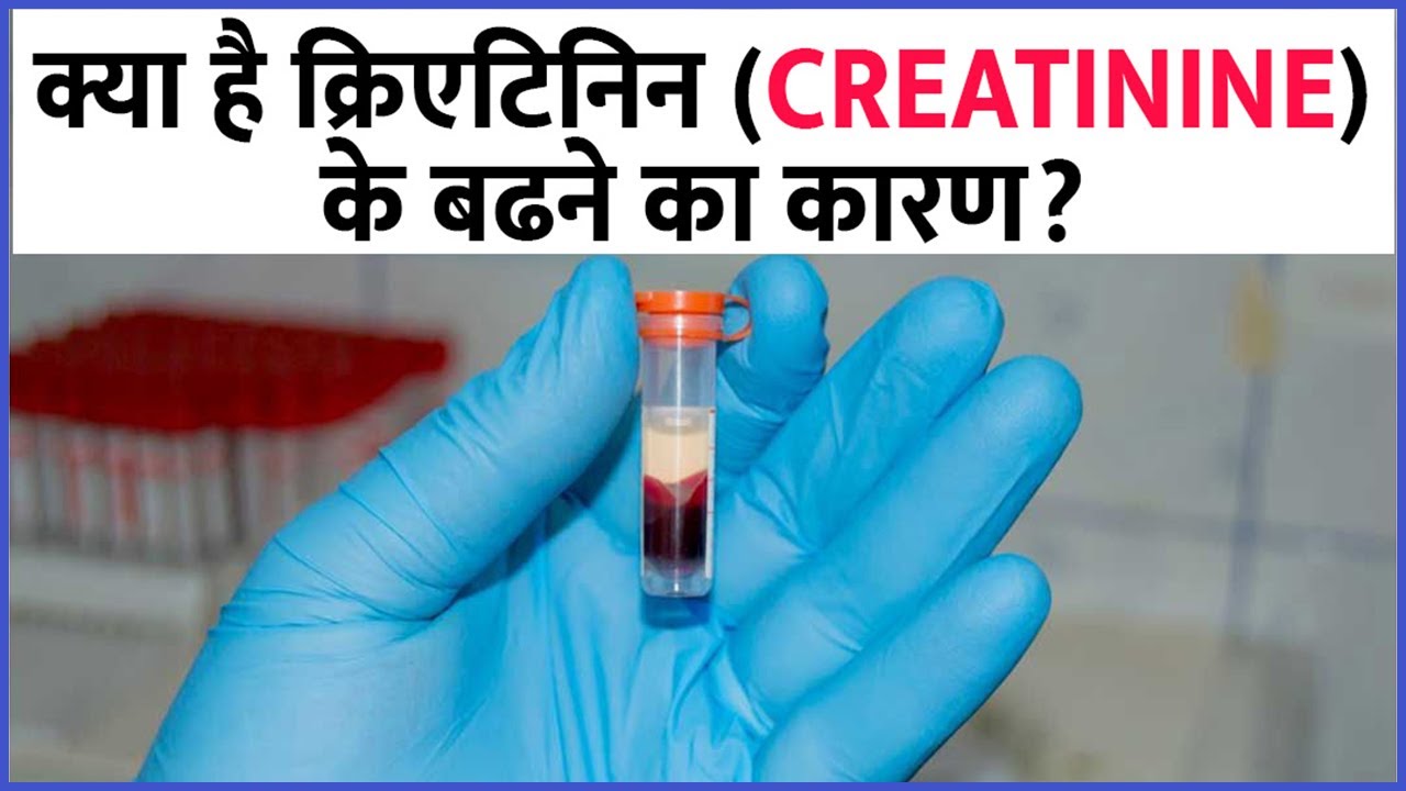 Creatinine kam karne ke upay  High Creatinine Levels Symptoms 