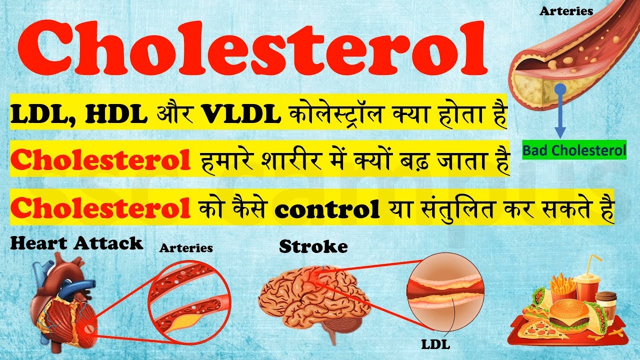 Cholesterol  LDL HDL  VLDL      cholesterol 