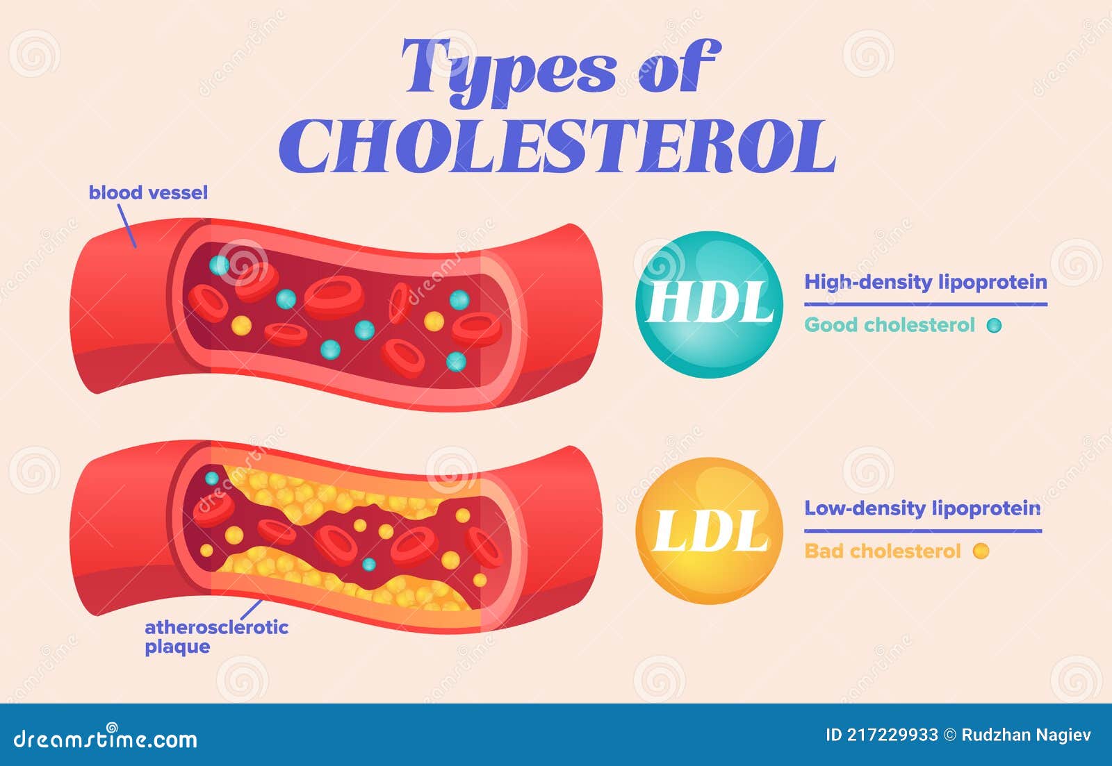 How to Control LDL Cholesterol in Urdu