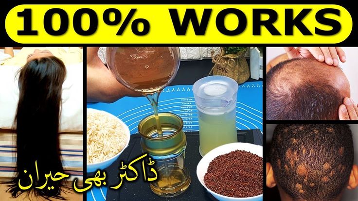 How to Get a Thicker Hairline in Urdu