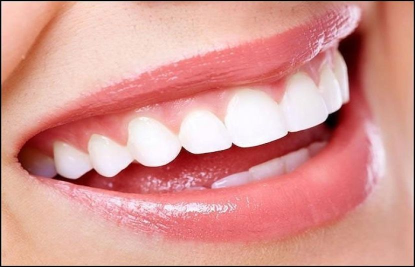How to Stop Tooth Decay from Spreading in Urdu