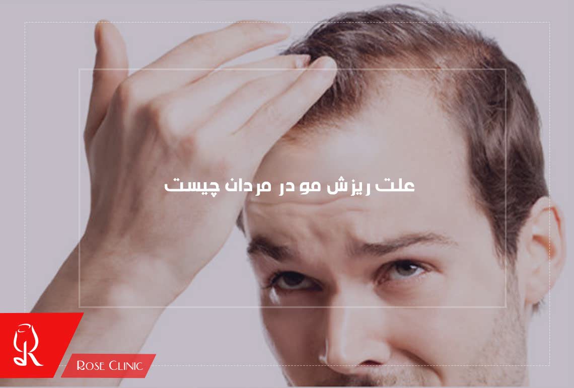 How Many Hair Loss Per Day Is Normal for Men in Urdu