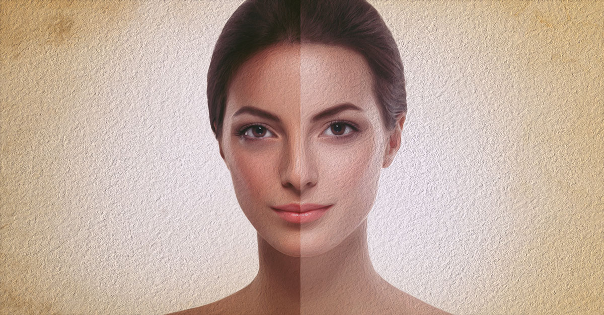 How to Reduce Melanin in Skin Permanently in Urdu