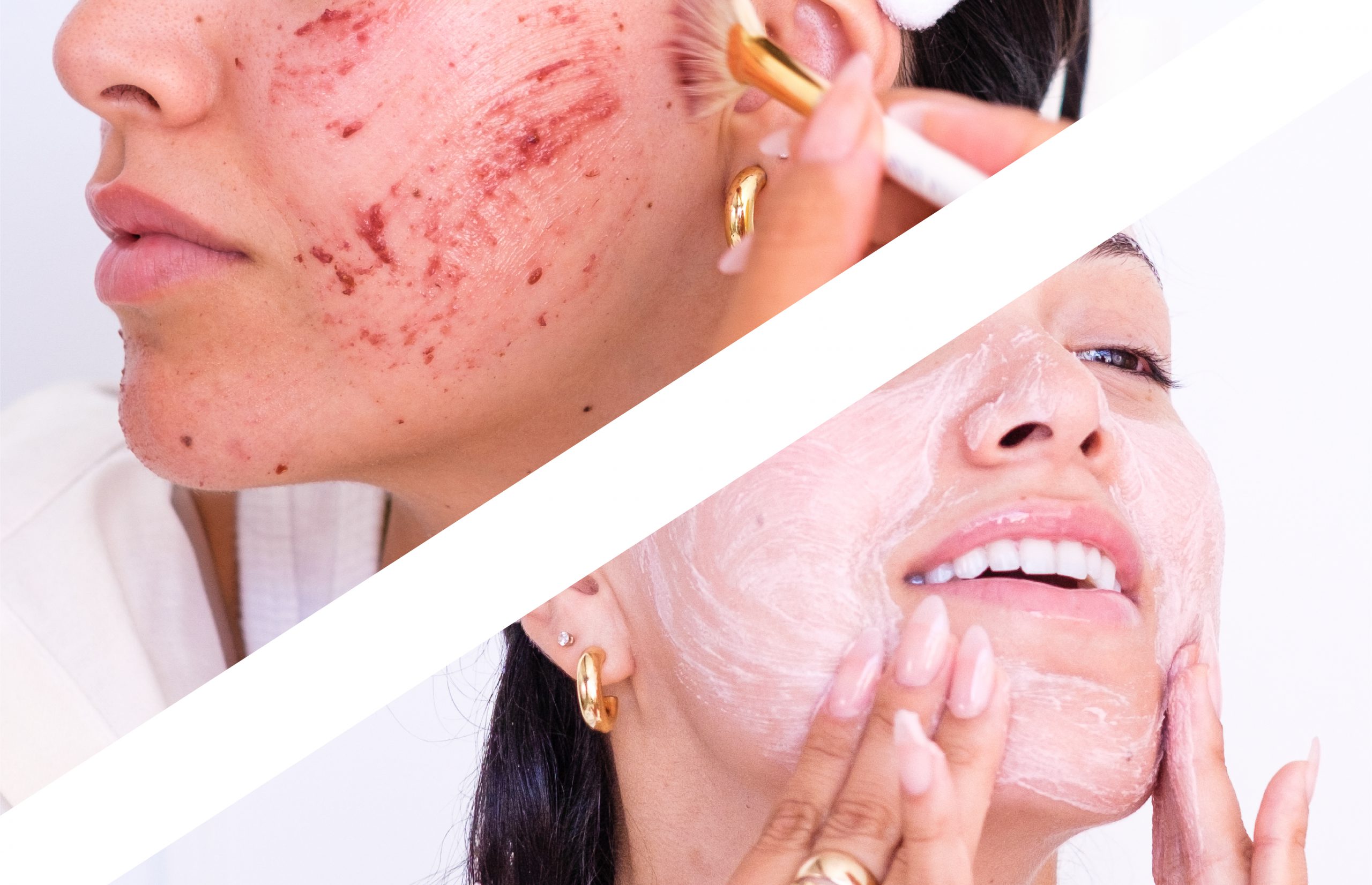 How to Remove Dark Spots on Face Fast Naturally in Urdu