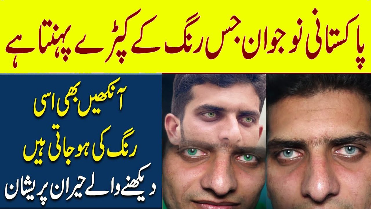 How to Change Your Eye Color to Red Permanently in Urdu