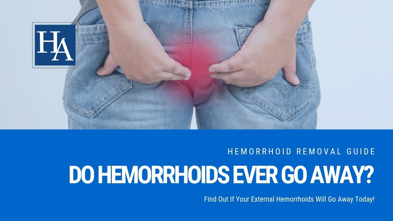 Understanding Hemorrhoids Do They Go Away