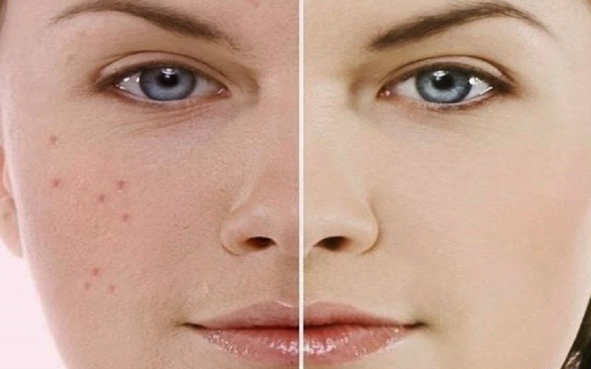 How to Remove Wrinkles from Face Quickly in Urdu