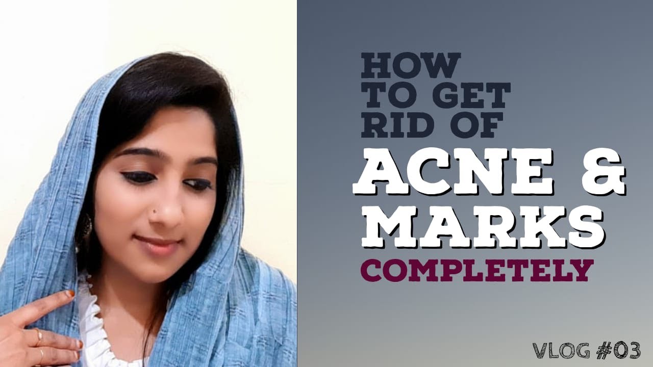 How To remove acnemarks     