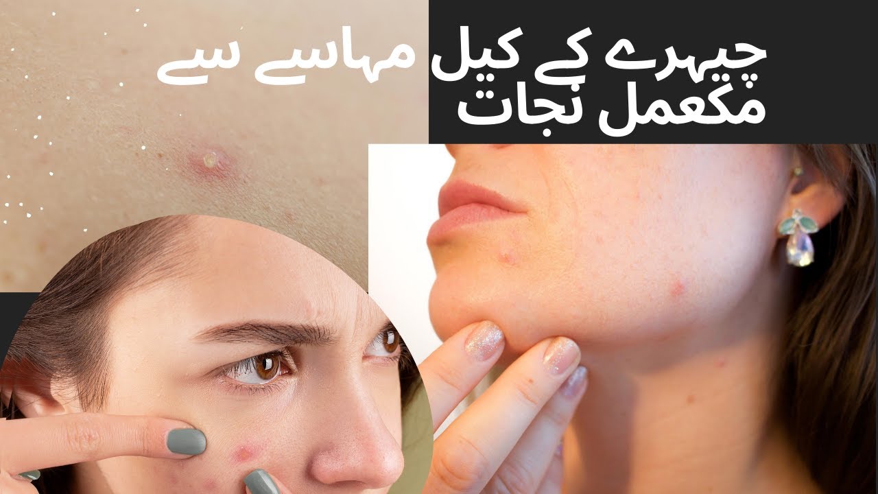 How to Avoid Acne Marks in Urdu