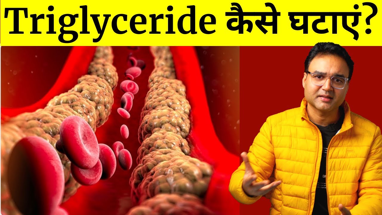 How to Lower Triglycerides Quickly in Urdu