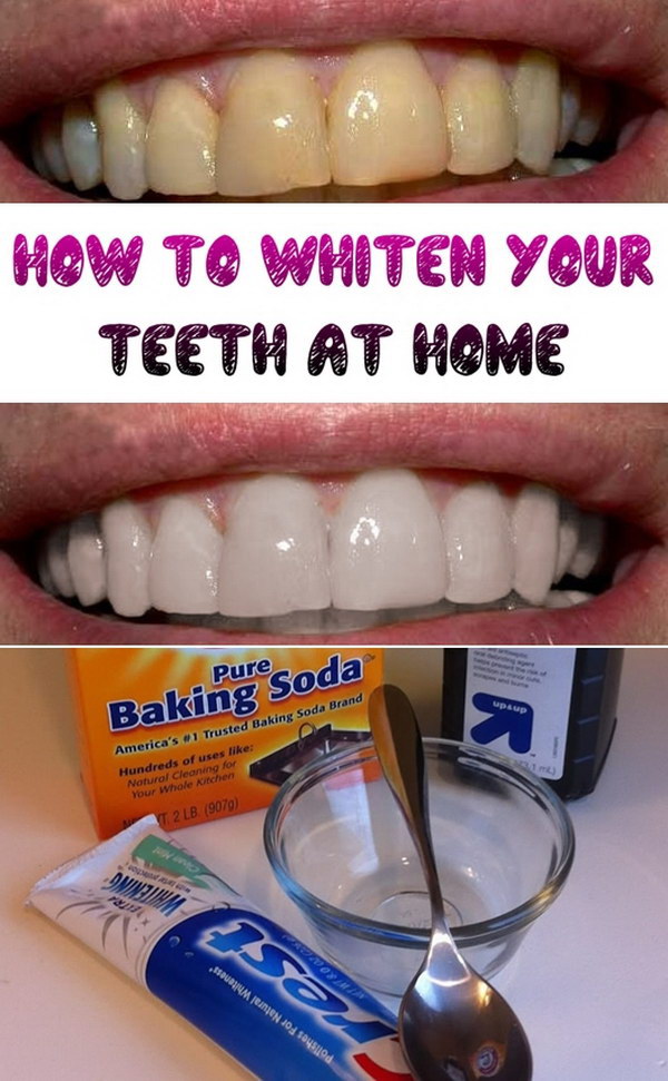 How to Whiten Teeth at Home in Urdu