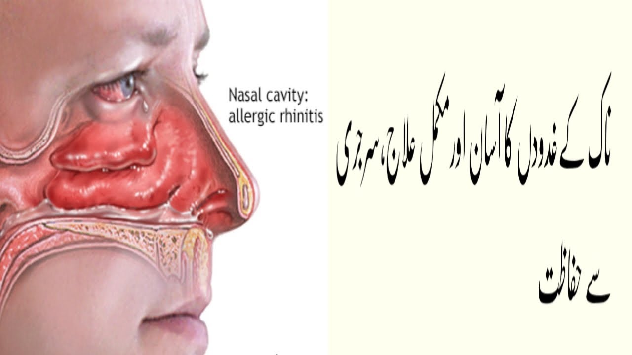 How to Make Your Nose Thinner in Urdu