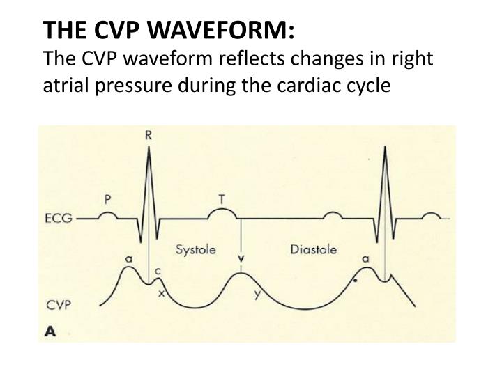 How to Measure CVP Pressure in Urdu