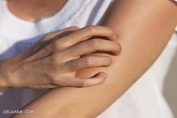 How to Avoid Itching in Urdu