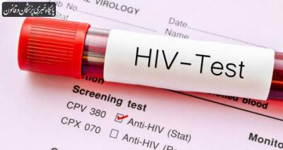 How is HIV Caused in Urdu