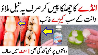 How to Remove Cavity from Teeth in Urdu