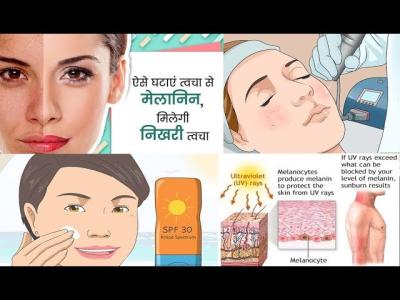 How to Reduce Melanin in Skin Permanently in Urdu