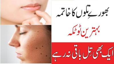 How to Remove Black Spots from Feet in Urdu