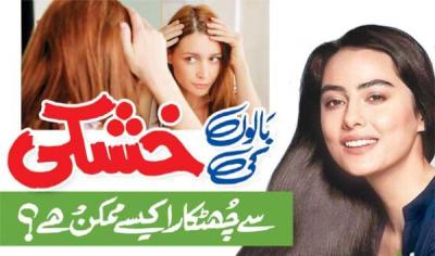 How to Get Rid of Dandruff in One Wash in Urdu