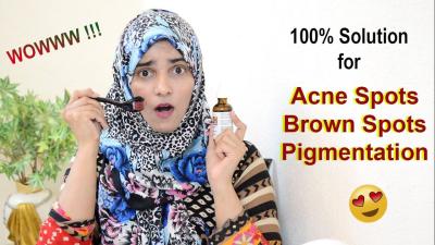 How to Remove Dark Spots on Face Fast Naturally in Urdu