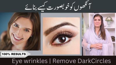 How to Soothe Itchy Eyes in Urdu