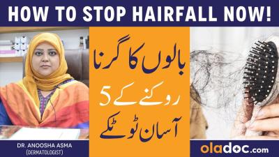 How to Stop Hair Receding in Urdu