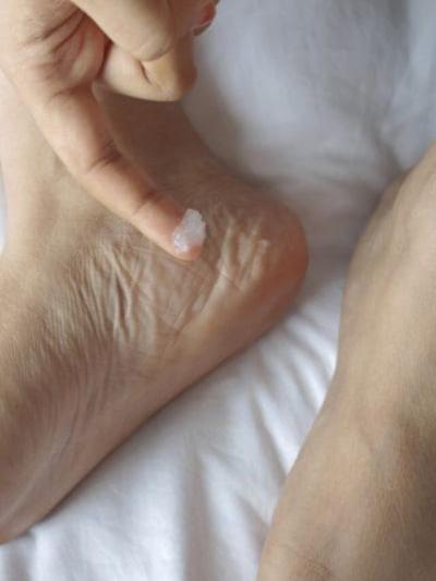 How to Cure Cracked Heels in Urdu