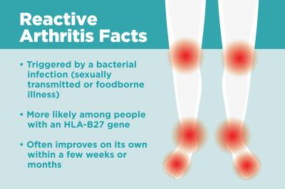 How Are Different Types of Arthritis Causes in Urdu