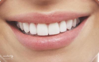 How to Brighten Your Teeth in Urdu