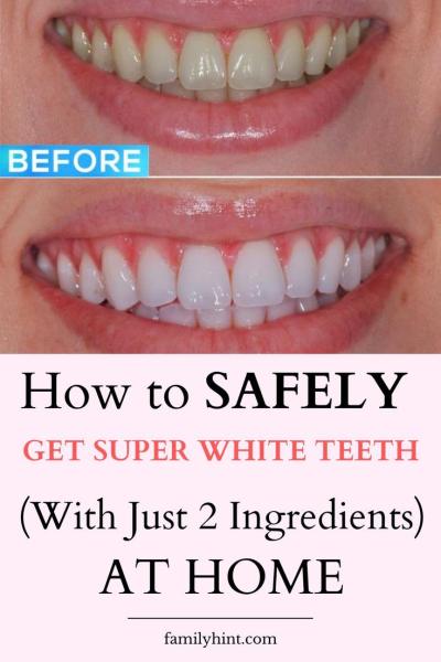 How to Whiten Teeth at Home in Urdu