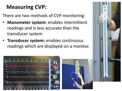 How to Measure CVP Pressure in Urdu