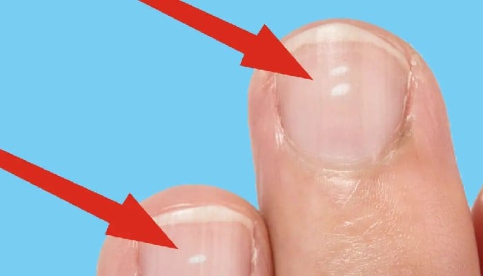 How Long Does It Take for Nails to Decompose in Urdu