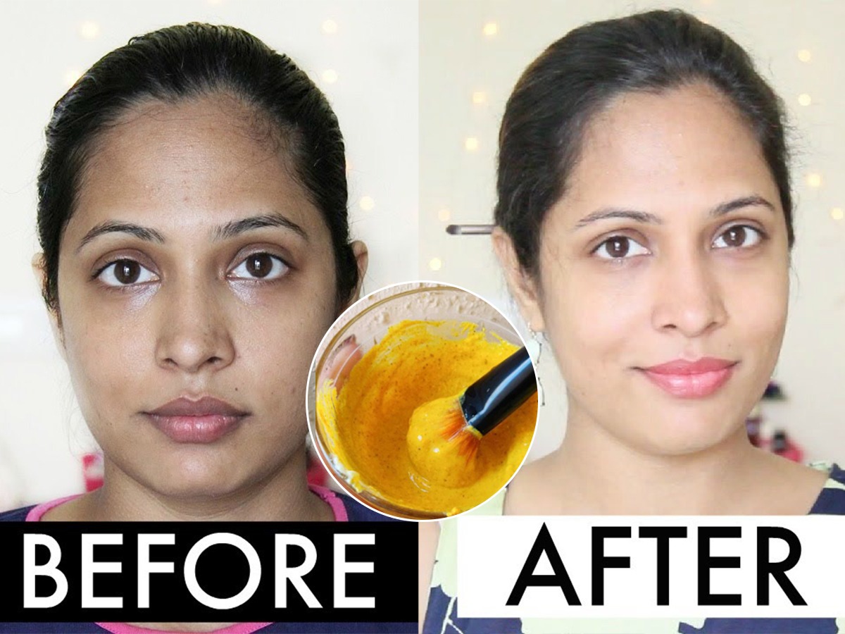 How To Remove Sun Tan Naturally       