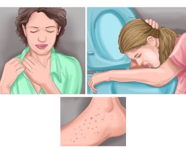 How to Reduce Fever in Adults in Urdu