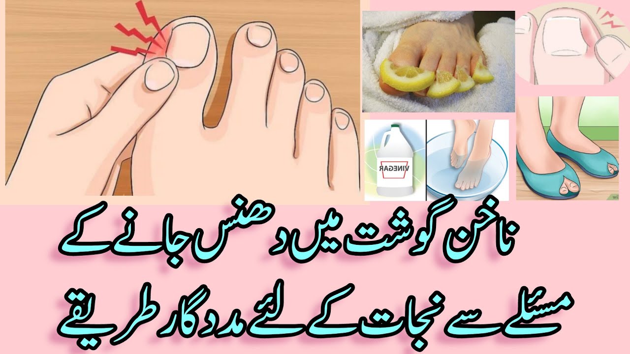 How to Beat Fungus on Normal in Urdu