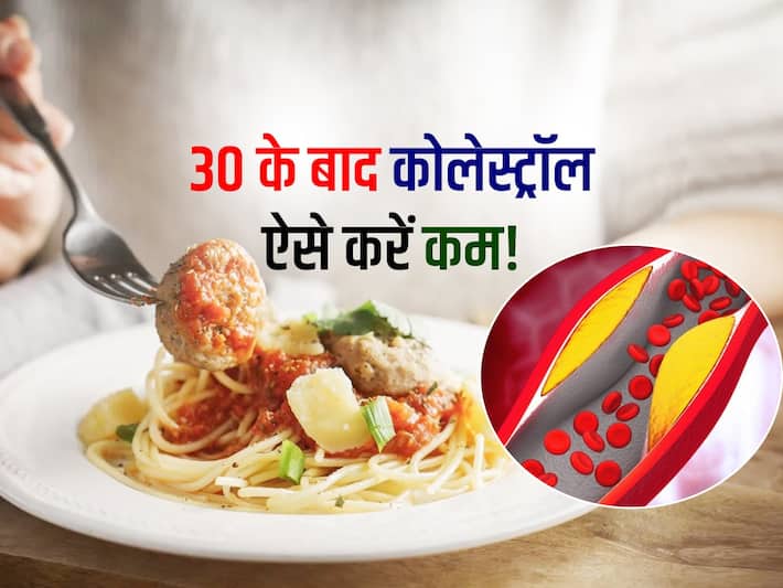 How to reduce cholesterol  30    5       
