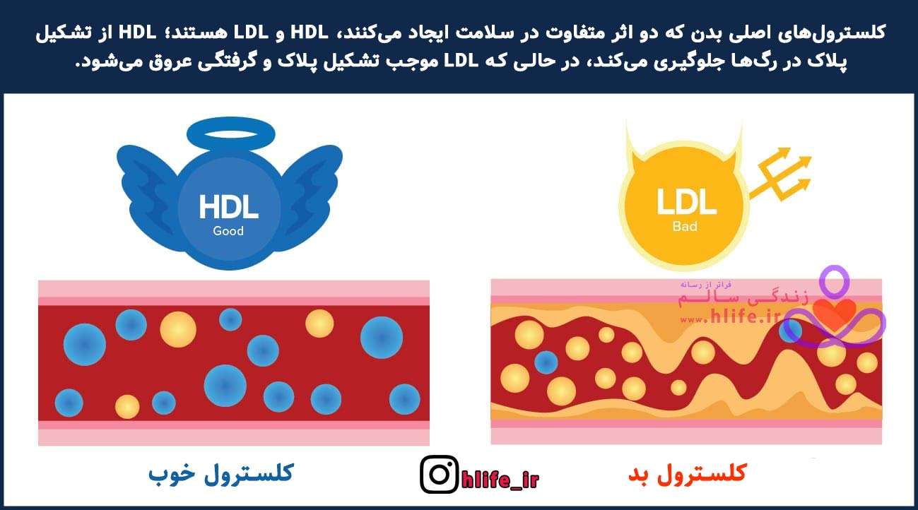 How to Lower Cholesterol Naturally in Urdu