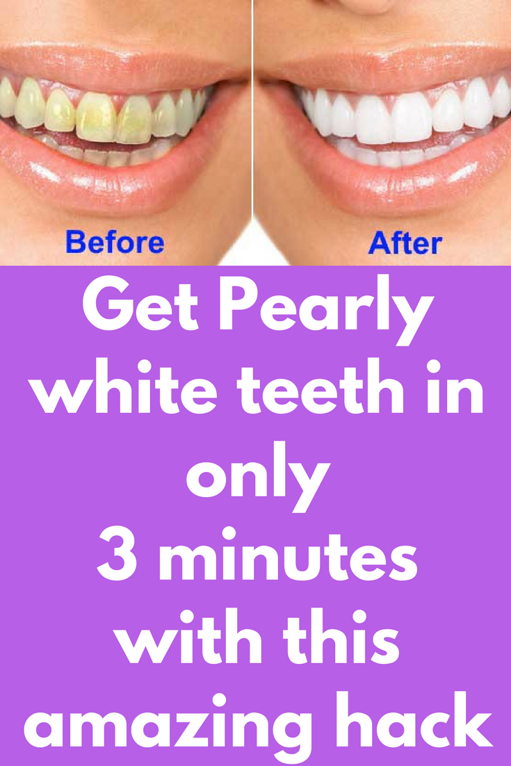 How to Whiten My Teeth in Urdu