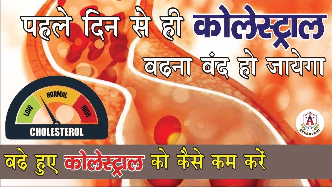 How Can I Lower My Cholesterol Quickly in Urdu