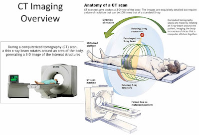 Educational World Computerized TomographyCT Scanner__ Educational World
