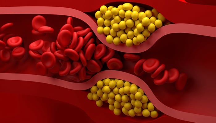 How to Increase HDL Cholesterol in Urdu