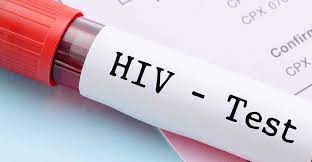 How Soon Can HIV Be Detected by a Blood Test in Urdu