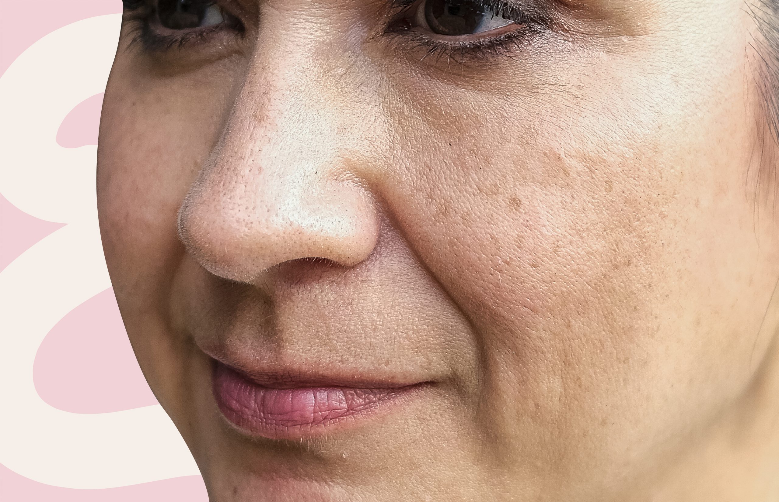 Brown Spots On Your Skin